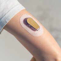 Dexcom Sticker für G6 (Transmitter) - Gold Glitzer